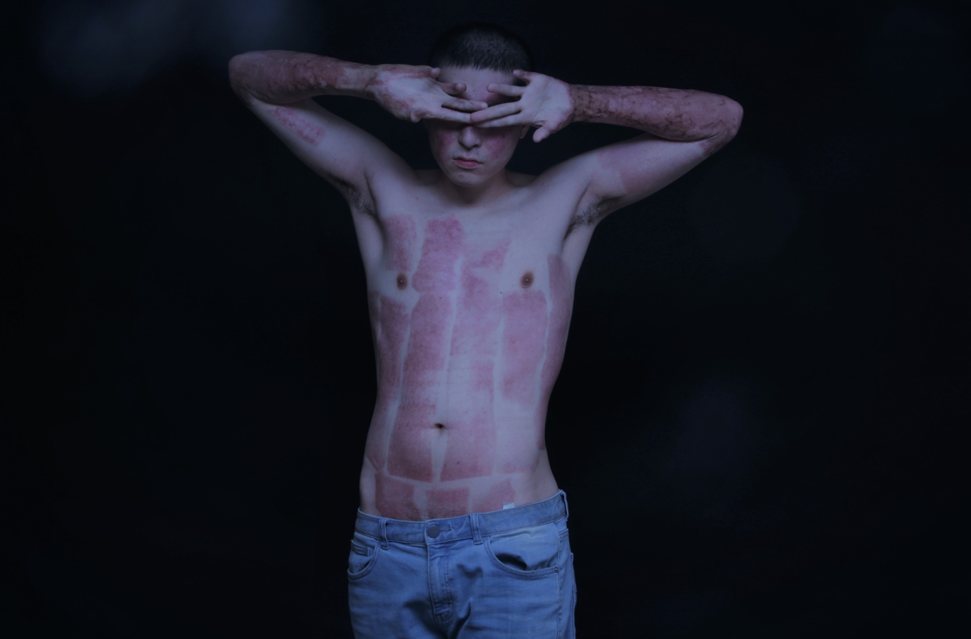 K9 자주포 사고로 큰 부상을 당한 이찬호 예비역 병장(25). 사고 이후의 자신의 치유 과정을 사진으로 기록한 모습들. 이 사진들은 화상환자들 뿐 아니라 장애인 등을 위한 사진전 및 책 출간에 사용될 예정이다.(사진: 이찬호 제공)