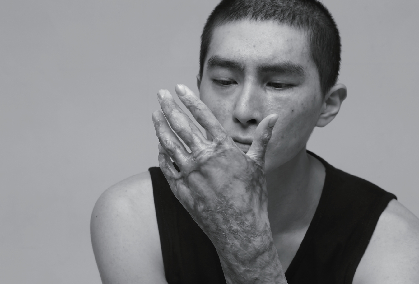 K9 자주포 사고로 큰 부상을 당한 이찬호 예비역 병장(25). 사고 이후의 자신의 치유 과정을 사진으로 기록한 모습들. 이 사진들은 화상환자들 뿐 아니라 장애인 등을 위한 사진전 및 책 출간에 사용될 예정이다.(사진: 이찬호 제공)