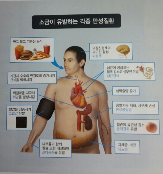 [심재억 기자의 헬스토리]-19=한국인의 ‘소금 중독’, 그 짜디 짠 현실