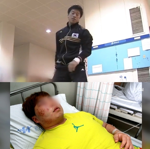 국가대표 사재혁, 후배 황우만 폭행. 사진=YTN 화면 캡처