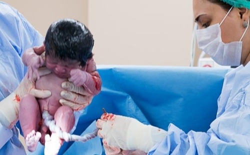 조산아 탯줄 묶기 60초만 미뤄도 사망률 크게 떨어진다  [출처: 시드니대학 홈페이지 캡처] 연합뉴스