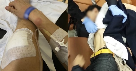 승리 클럽 버닝썬 폭행 사건