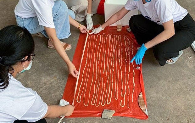 환자는 기생충 퇴치약을 처방받았고, 18m 기생충을 배출했다. 사람의 직장 길이가 20cm 정도인 것을 감안하면 엄청난 크기다.