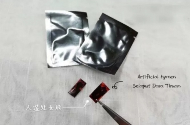 말레이시아에서는 인터넷 쇼핑몰 등지에서 첫날밤을 앞 둔 여성들을 대상으로 ‘인공 처녀막’을 판매하고 있다. 트위터 캡처