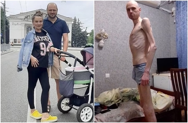 전쟁 중 러시아군에 포로로 잡혔다 풀려난 한 우크라이나 병사의 사진이 충격을 안겼다. 볼로디미르 체마부르소프의 과거(왼쪽)와 최근 모습. 엑스(X·옛 트위터)