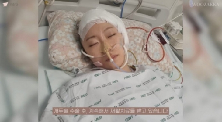 승무원, 은행원 출신 강연자로 활발히 활동하던 유튜버 ‘우자까’가 불의의 사고로 뇌 일부와 왼쪽 머리뼈를 깎아냈다고 전했다. 유튜브 캡처
