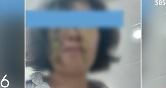 학부모에 똥기저귀를 맞은 어린이집 교사. SBS 모닝와이드 보도 영상 캡처