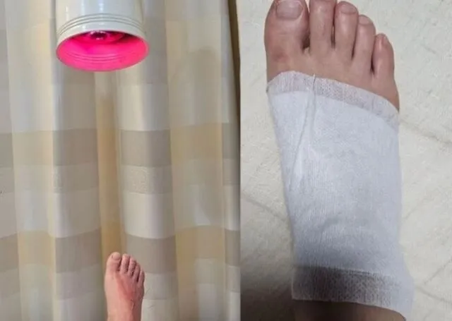 코미디언 이경실이 목욕탕에서 미끄러지는 사고를 당했다. 이경실 인스타그램 캡처 코미디언 이경실이 목욕탕에서 미끄러지는 사고를 당했다. 이경실 인스타그램 캡처